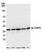 Charged multivesicular body protein 3 antibody, A305-397A, Bethyl Labs, Western Blot image 