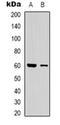 CAP-Gly Domain Containing Linker Protein 3 antibody, orb319001, Biorbyt, Western Blot image 