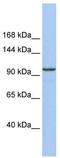 Klotho Beta antibody, TA337557, Origene, Western Blot image 
