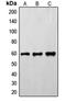 FYN Proto-Oncogene, Src Family Tyrosine Kinase antibody, orb213956, Biorbyt, Western Blot image 
