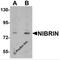 Nibrin antibody, 6841, ProSci, Western Blot image 