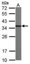 Capping Actin Protein Of Muscle Z-Line Subunit Alpha 2 antibody, GTX114303, GeneTex, Western Blot image 