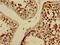 ELMO Domain Containing 2 antibody, CSB-PA815588LA01HU, Cusabio, Immunohistochemistry paraffin image 