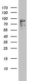 F-Box Protein 11 antibody, NBP2-45620, Novus Biologicals, Western Blot image 