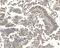 Patched 2 antibody, A06375-1, Boster Biological Technology, Immunohistochemistry paraffin image 