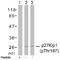 Cyclin Dependent Kinase Inhibitor 1B antibody, AP02472PU-S, Origene, Western Blot image 