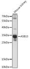 Ankyrin Repeat And SOCS Box Containing 13 antibody, 16-309, ProSci, Western Blot image 