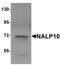 NLR Family Pyrin Domain Containing 10 antibody, orb94580, Biorbyt, Western Blot image 
