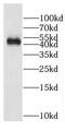 DNA Damage Inducible 1 Homolog 1 antibody, FNab02288, FineTest, Western Blot image 