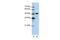 Nucleolar Protein 4 antibody, GTX47373, GeneTex, Western Blot image 