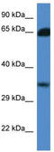 Methylthioribose-1-phosphate isomerase antibody, TA342961, Origene, Western Blot image 