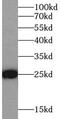 P09211 antibody, FNab09854, FineTest, Western Blot image 
