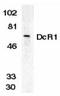 TNF Receptor Superfamily Member 10c antibody, TA306012, Origene, Western Blot image 