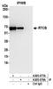 RNA 2',3'-Cyclic Phosphate And 5'-OH Ligase antibody, A305-079A, Bethyl Labs, Immunoprecipitation image 