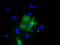 Pyruvate Kinase L/R antibody, LS-C115403, Lifespan Biosciences, Immunofluorescence image 