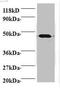 Canopy FGF Signaling Regulator 2 antibody, A53985-100, Epigentek, Western Blot image 