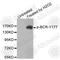 BCR Activator Of RhoGEF And GTPase antibody, AP0205, ABclonal Technology, Western Blot image 