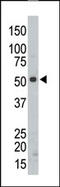 Src-Related Kinase Lacking C-Terminal Regulatory Tyrosine And N-Terminal Myristylation Sites antibody, AP14478PU-N, Origene, Western Blot image 