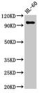 Histone-lysine N-methyltransferase SUV420H1 antibody, LS-C672815, Lifespan Biosciences, Western Blot image 