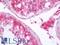 StAR-related lipid transfer protein 7, mitochondrial antibody, LS-C317356, Lifespan Biosciences, Immunohistochemistry paraffin image 