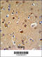 Telomere Maintenance 2 antibody, 61-673, ProSci, Immunohistochemistry paraffin image 