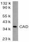 DNA Fragmentation Factor Subunit Beta antibody, A05374-1, Boster Biological Technology, Western Blot image 