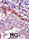 Hormonally Up-Regulated Neu-Associated Kinase antibody, 63-304, ProSci, Immunohistochemistry paraffin image 