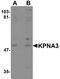 Importin subunit alpha-3 antibody, A06131, Boster Biological Technology, Western Blot image 