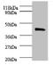 PRKCA-binding protein antibody, A55770-100, Epigentek, Western Blot image 