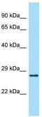 Abhydrolase Domain Containing 14A antibody, TA331954, Origene, Western Blot image 