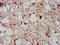 CD11A antibody, CSB-PA05204A0Rb, Cusabio, Immunohistochemistry frozen image 