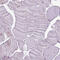 Glutaryl-CoA Dehydrogenase antibody, HPA048492, Atlas Antibodies, Immunohistochemistry frozen image 