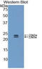 Bone Morphogenetic Protein 1 antibody, LS-C297552, Lifespan Biosciences, Western Blot image 