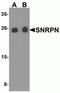 Small Nuclear Ribonucleoprotein Polypeptide N antibody, NBP2-81851, Novus Biologicals, Western Blot image 