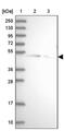 SPRY Domain Containing 3 antibody, PA5-58784, Invitrogen Antibodies, Western Blot image 