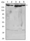 RPTOR Independent Companion Of MTOR Complex 2 antibody, AM06499SU-N, Origene, Western Blot image 