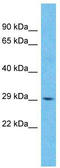 Zinc Finger DHHC-Type Containing 22 antibody, TA330836, Origene, Western Blot image 