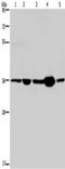 Leucine Zipper Transcription Factor Like 1 antibody, TA350147, Origene, Western Blot image 