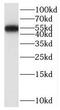 Sterile Alpha Motif Domain Containing 14 antibody, FNab07587, FineTest, Western Blot image 