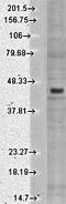 Potassium Voltage-Gated Channel Subfamily J Member 4 antibody, orb67402, Biorbyt, Western Blot image 
