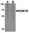 Lysine-specific histone demethylase 1B antibody, TA326673, Origene, Western Blot image 