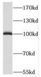 Microtubule Associated Protein 7 antibody, FNab04985, FineTest, Western Blot image 