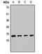Slingshot Protein Phosphatase 2 antibody, LS-C668896, Lifespan Biosciences, Western Blot image 