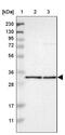 Electron Transfer Flavoprotein Subunit Alpha antibody, NBP1-84856, Novus Biologicals, Western Blot image 