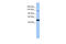 Mitogen-activated protein kinase kinase kinase 1 antibody, 30-433, ProSci, Western Blot image 