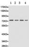 GRP-75 antibody, TA321626, Origene, Western Blot image 
