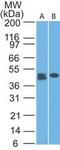 C-Type Lectin Domain Containing 9A antibody, TA337135, Origene, Western Blot image 