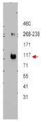 ATP Binding Cassette Subfamily B Member 5 antibody, AP09395PU-S, Origene, Western Blot image 