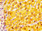 Alcohol Dehydrogenase 1A (Class I), Alpha Polypeptide antibody, LS-C669693, Lifespan Biosciences, Immunohistochemistry paraffin image 
