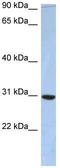PDZ Domain Containing 9 antibody, TA331415, Origene, Western Blot image 